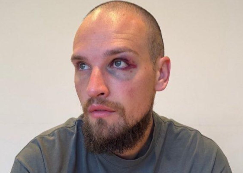 تفاصيل جديدة حول إصابة رايكوفيتش المقلقة